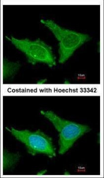 FIBB Antibody in Immunocytochemistry (ICC/IF)