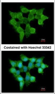 FMO3 Antibody in Immunocytochemistry (ICC/IF)