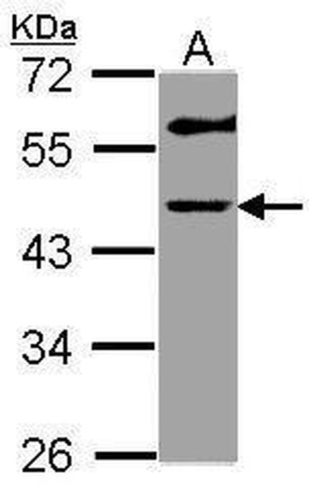 GALT Antibody in Western Blot (WB)