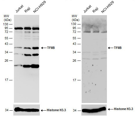 GTF2B Antibody in Western Blot (WB)