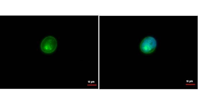 HLA-DRA Antibody in Immunocytochemistry (ICC/IF)