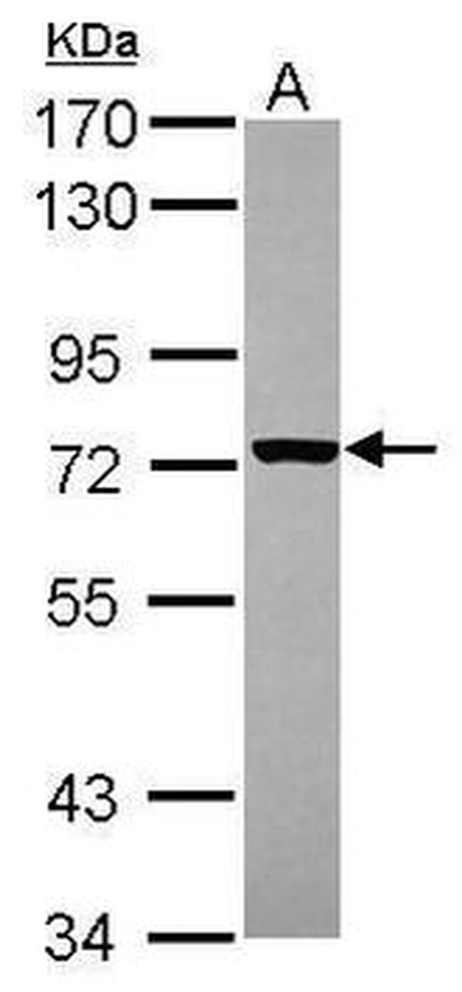 CD122 Antibody in Western Blot (WB)