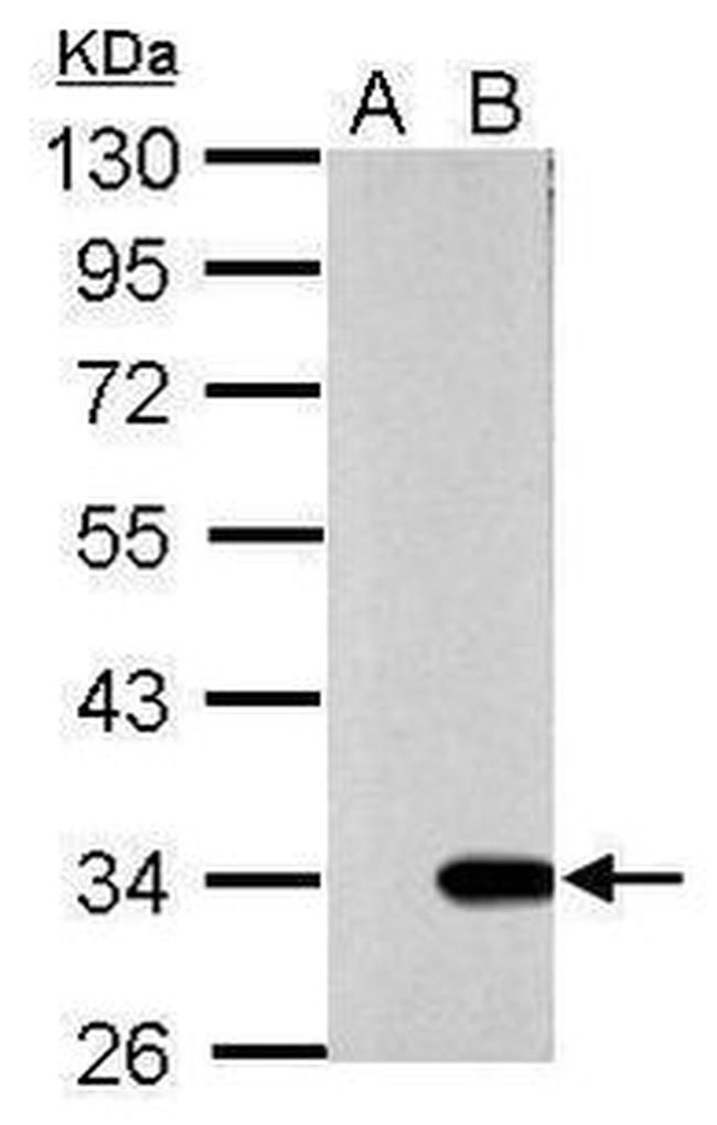 Galectin 9 Antibody in Western Blot (WB)