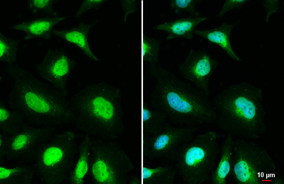 MSH3 Antibody in Immunocytochemistry (ICC/IF)