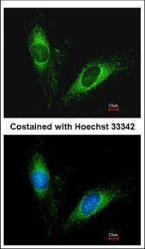 SERPINA5 Antibody in Immunocytochemistry (ICC/IF)