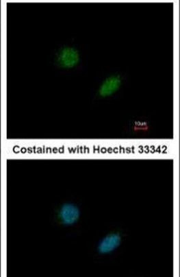POLD1 Antibody in Immunocytochemistry (ICC/IF)