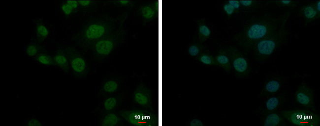 PSMD10 Antibody in Immunocytochemistry (ICC/IF)