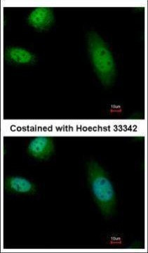 RAD23B Antibody in Immunocytochemistry (ICC/IF)