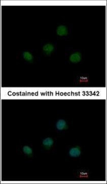 TBX5 Antibody in Immunocytochemistry (ICC/IF)