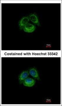 TRPC6 Antibody in Immunocytochemistry (ICC/IF)