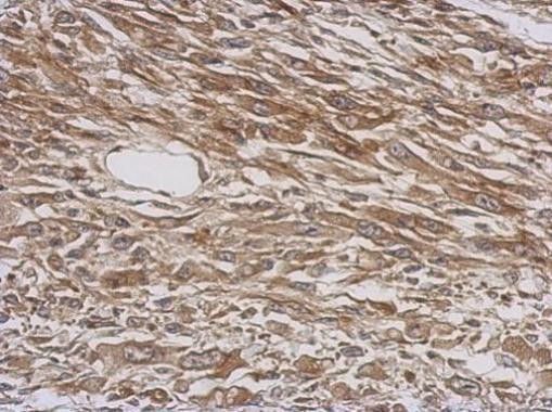 WARS Antibody in Immunohistochemistry (Paraffin) (IHC (P))