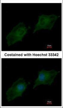 SRC3 Antibody in Immunocytochemistry (ICC/IF)