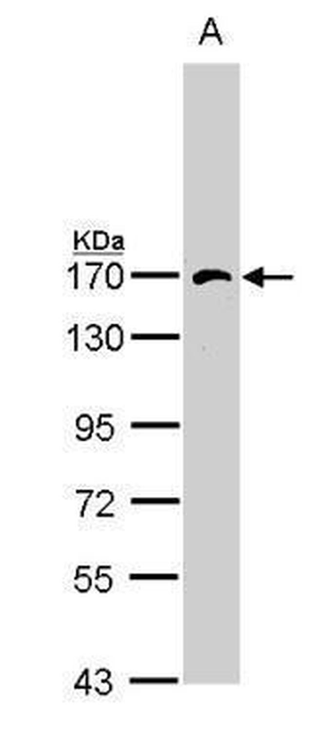 AP3B1 Antibody in Western Blot (WB)