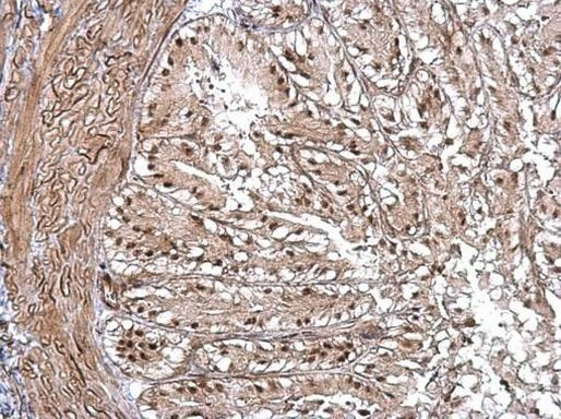 PIAS1 Antibody in Immunohistochemistry (Paraffin) (IHC (P))