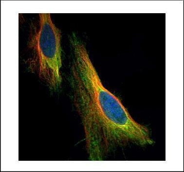 ARC Antibody in Immunocytochemistry (ICC/IF)