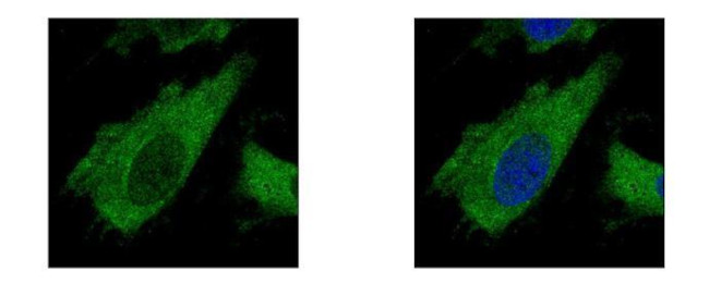 AIP Antibody in Immunocytochemistry (ICC/IF)
