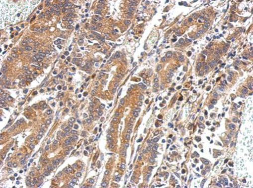 PAPSS2 Antibody in Immunohistochemistry (Paraffin) (IHC (P))
