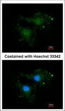 Bcl-B Antibody in Immunocytochemistry (ICC/IF)
