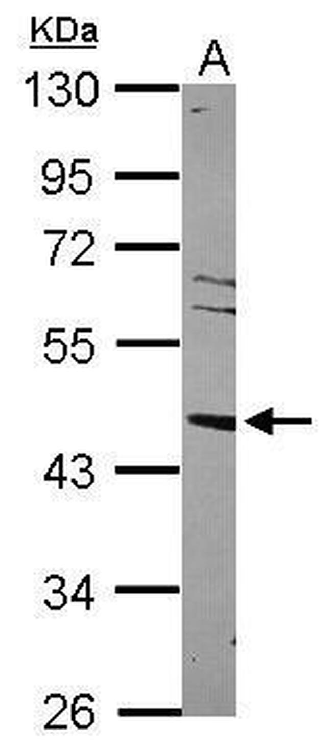 LXR alpha Antibody in Western Blot (WB)