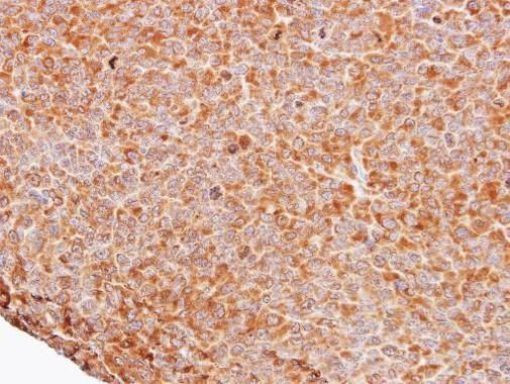 FBXW11 Antibody in Immunohistochemistry (Paraffin) (IHC (P))