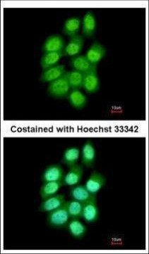 PADI4 Antibody in Immunocytochemistry (ICC/IF)