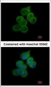 BACE2 Antibody in Immunocytochemistry (ICC/IF)