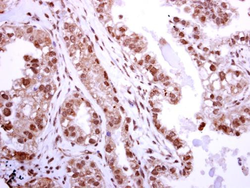 BRIP1 Antibody in Immunohistochemistry (Paraffin) (IHC (P))