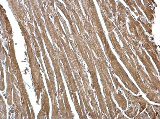 FHL2 Antibody in Immunohistochemistry (Paraffin) (IHC (P))