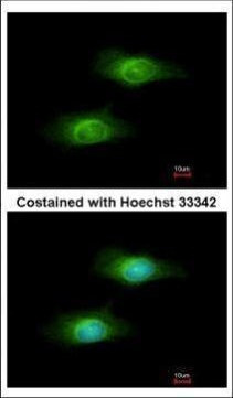GCLM Antibody in Immunocytochemistry (ICC/IF)