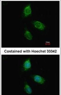 Granulins Antibody in Immunocytochemistry (ICC/IF)