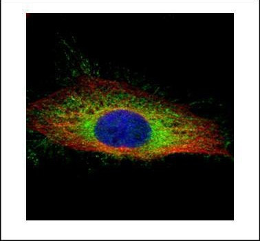 Gelsolin Antibody in Immunocytochemistry (ICC/IF)