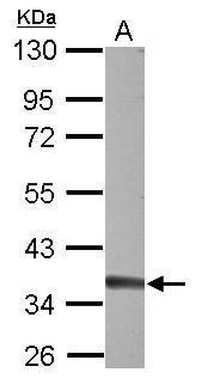 TREX1 Antibody in Western Blot (WB)