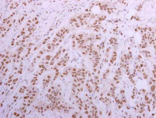 CUGBP1 Antibody in Immunohistochemistry (Paraffin) (IHC (P))