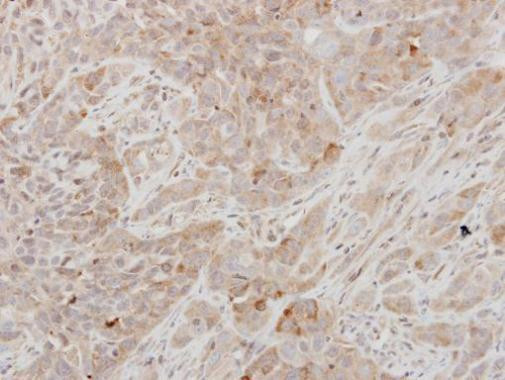 Prolactin Antibody in Immunohistochemistry (Paraffin) (IHC (P))