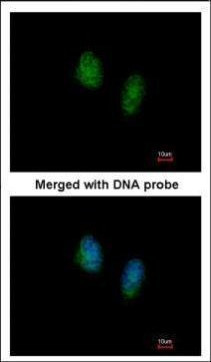 RAN Antibody in Immunocytochemistry (ICC/IF)