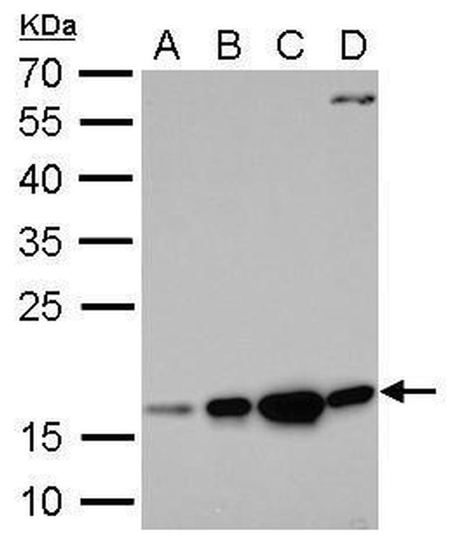 Destrin Antibody in Western Blot (WB)