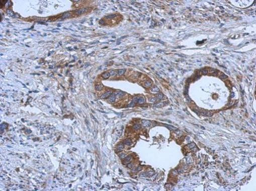 GGA1 Antibody in Immunohistochemistry (Paraffin) (IHC (P))