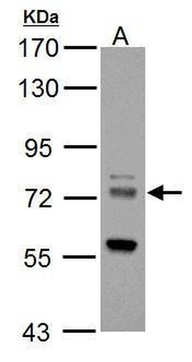 ZDHHC17 Antibody in Western Blot (WB)