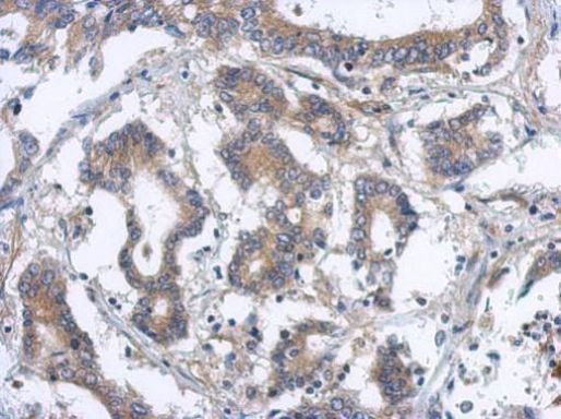 DAPK2 Antibody in Immunohistochemistry (Paraffin) (IHC (P))