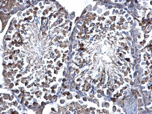 SUFU Antibody in Immunohistochemistry (Paraffin) (IHC (P))