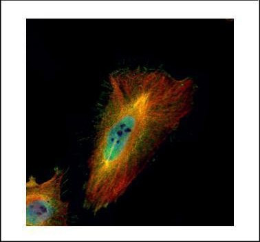 ABCF1 Antibody in Immunocytochemistry (ICC/IF)