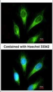 Acid Phosphatase 2 Antibody in Immunocytochemistry (ICC/IF)