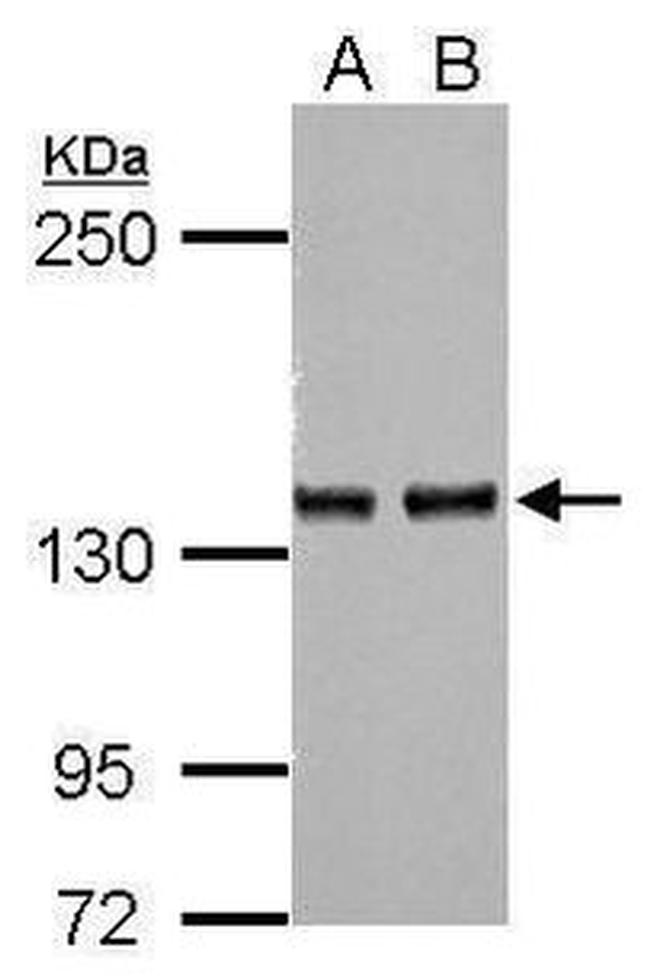 Adenylate Cyclase 7 Antibody in Western Blot (WB)