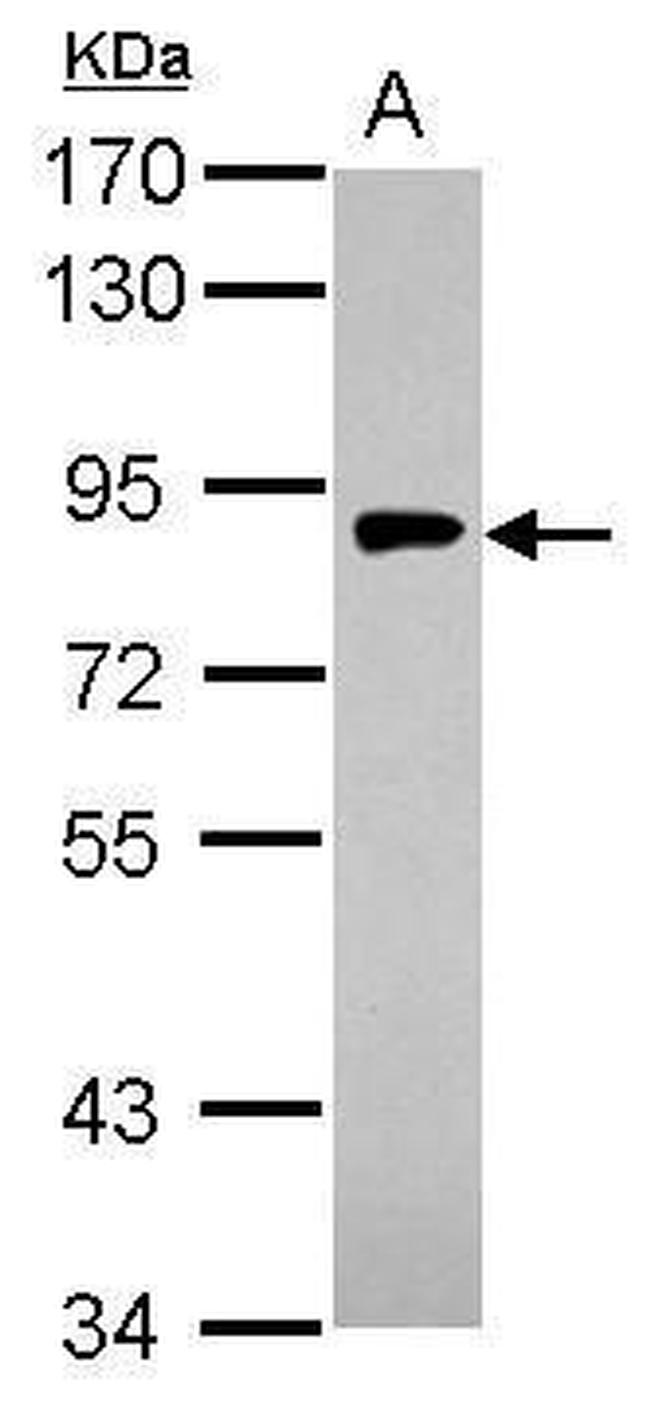 gamma Adaptin Antibody in Western Blot (WB)