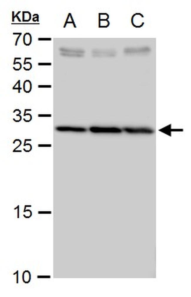SLC25A6 Antibody in Western Blot (WB)