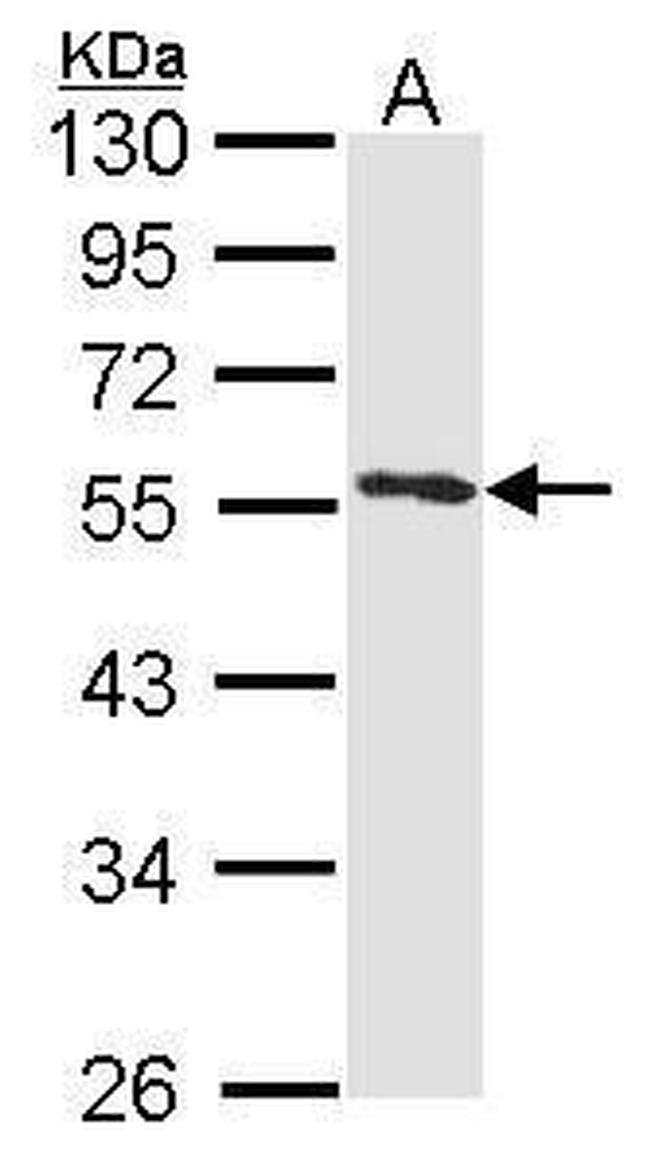 Annexin A11 Antibody in Western Blot (WB)
