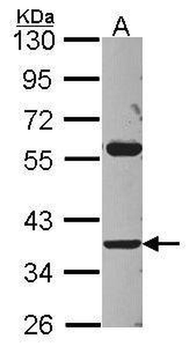 ART3 Antibody in Western Blot (WB)