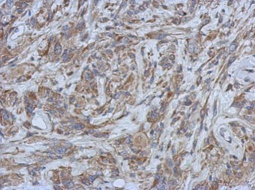 Filensin Antibody in Immunohistochemistry (Paraffin) (IHC (P))