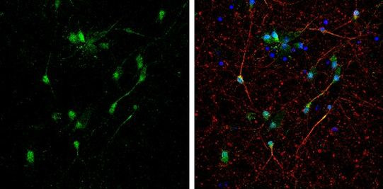 BNIP2 Antibody in Immunocytochemistry (ICC/IF)