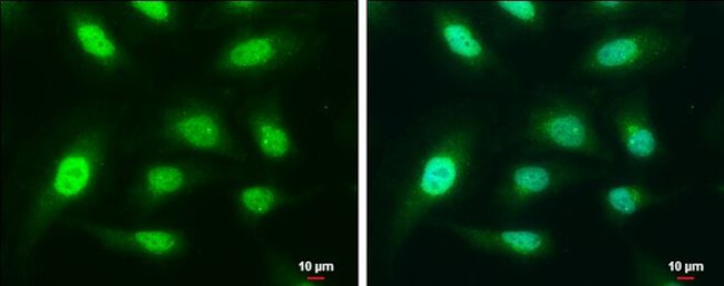 CAPG Antibody in Immunocytochemistry (ICC/IF)